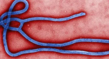 Ebola virus