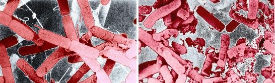 Bacteria before and after sterilization