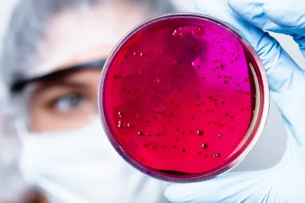 Lab technician looking at spores in agar in a petri dish